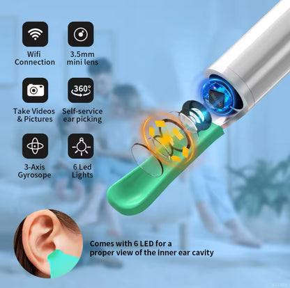 EARWIX - Visual Ear Cleaner